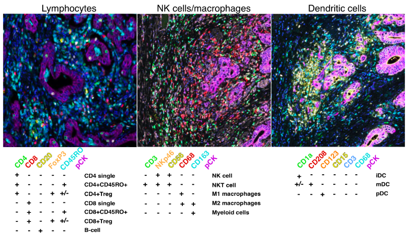 Pathology data analysis using statistical methods to uncover molecular and clinical patterns in cancer.